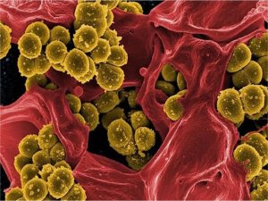 Polonyada lejyonella bakterisi nedeniyle ölenlerin sayısı 3e yükseldi 