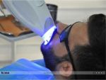 Uzmanlar uyardı: Bilinçsiz kullanılan diş beyazlatma ürünleri diş kaybına neden olabilir!  