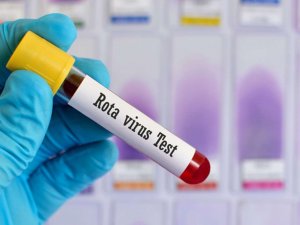 Rota virüsü nedir?