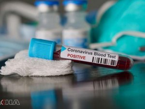 İki haftalık Coronavirus tablosu açıklandı