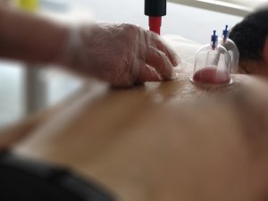 Alternatif tıp ve şifa kaynağı: Hacamat