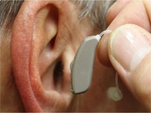 İşitme kaybı hangi faktörlere bağlı oluşur? Belirtileri nelerdir? Tedavi Yolları nelerdir?