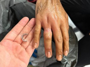 Parmağına sıkışan yüzük itfaiye ekiplerince çıkarıldı