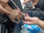 Batmanda parmakta sıkışan yüzük operasyonla çıkarıldı